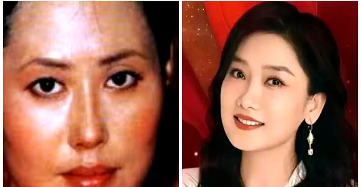 那尔那茜遗传了谁呢？图一左边是她爸爸塞纳，右边是她妈妈敖登高娃。