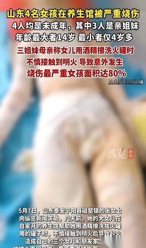 “妈，我帮你。”山东泰安，14岁的女儿拿起桌上的酒精瓶，想替妈妈擦一下那个拔火