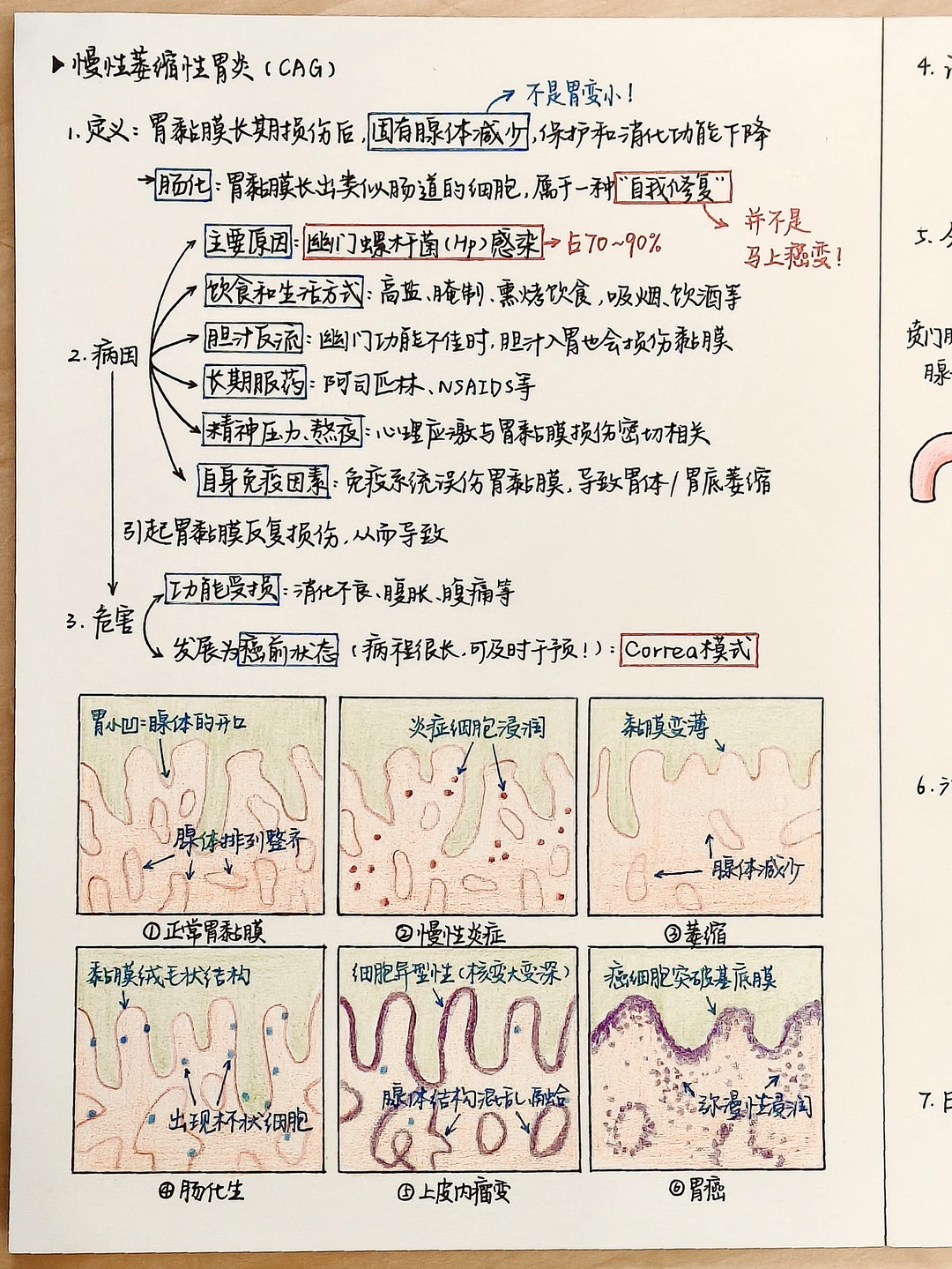 医学生笔记｜一张图看懂萎缩性胃炎