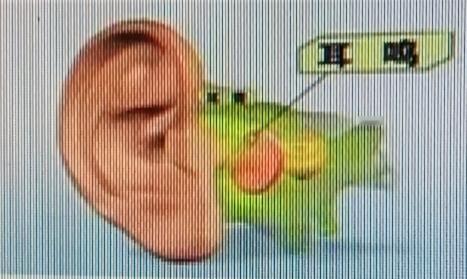 耳鸣真的太折磨人了！不少人一到晚上耳朵就嗡嗡响，像有只蚊子在脑子里，起初偶尔响，