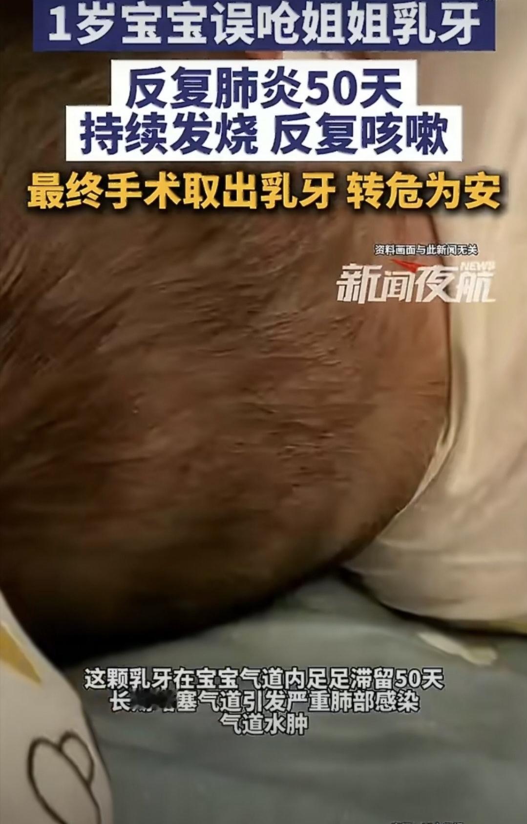 家里有两个孩子的都知道，日常打闹里藏着太多想不到的危险。最近就发生了一件让所有家