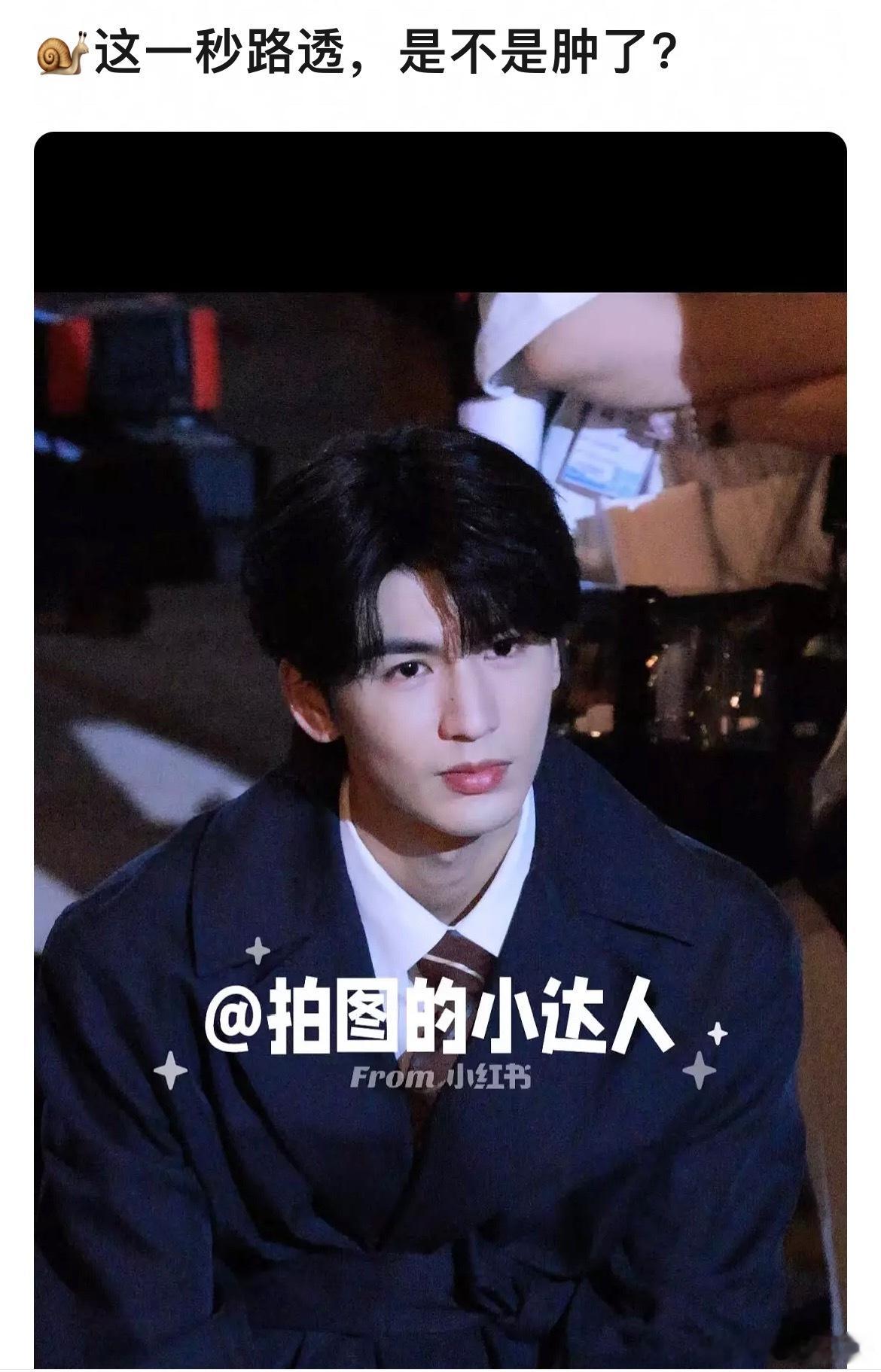 张凌赫这一秒路透，肿了吗​​​