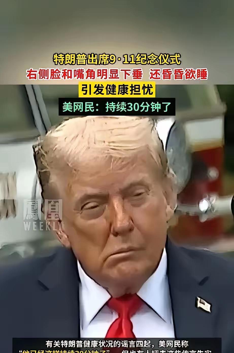 特朗普就像变了个人。从怼天怼地、劲使不完的战斗状态，变得一脸颓废、没了精气神柯