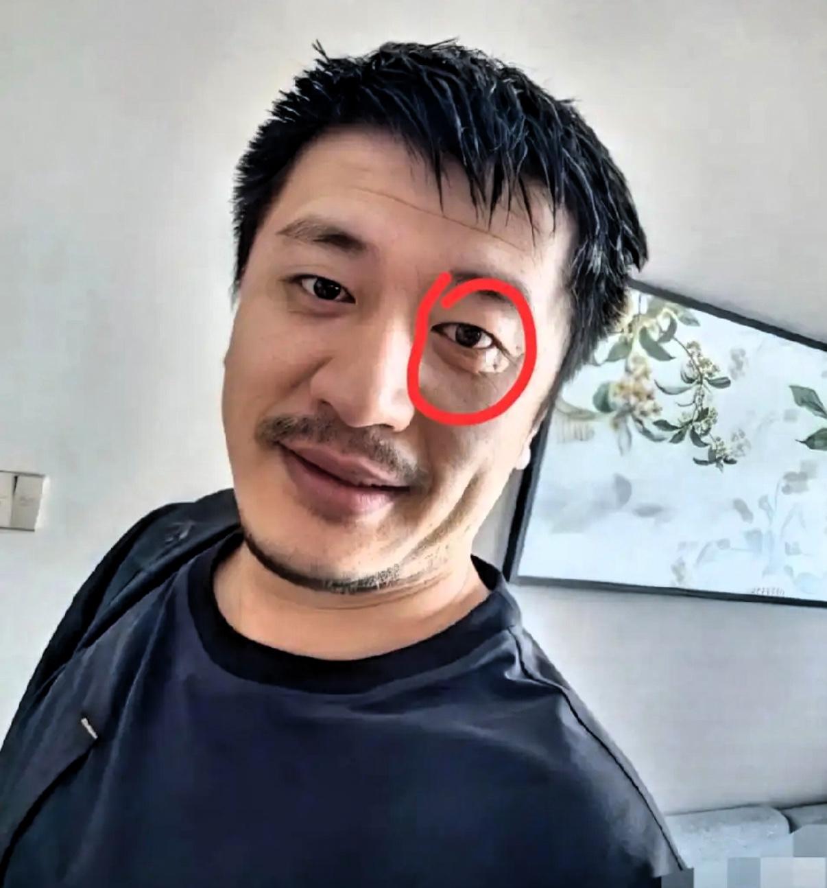 张雪峰身上还有个疑点，想了一夜也没有想通，就是他有专业的护理团队，按说这种事