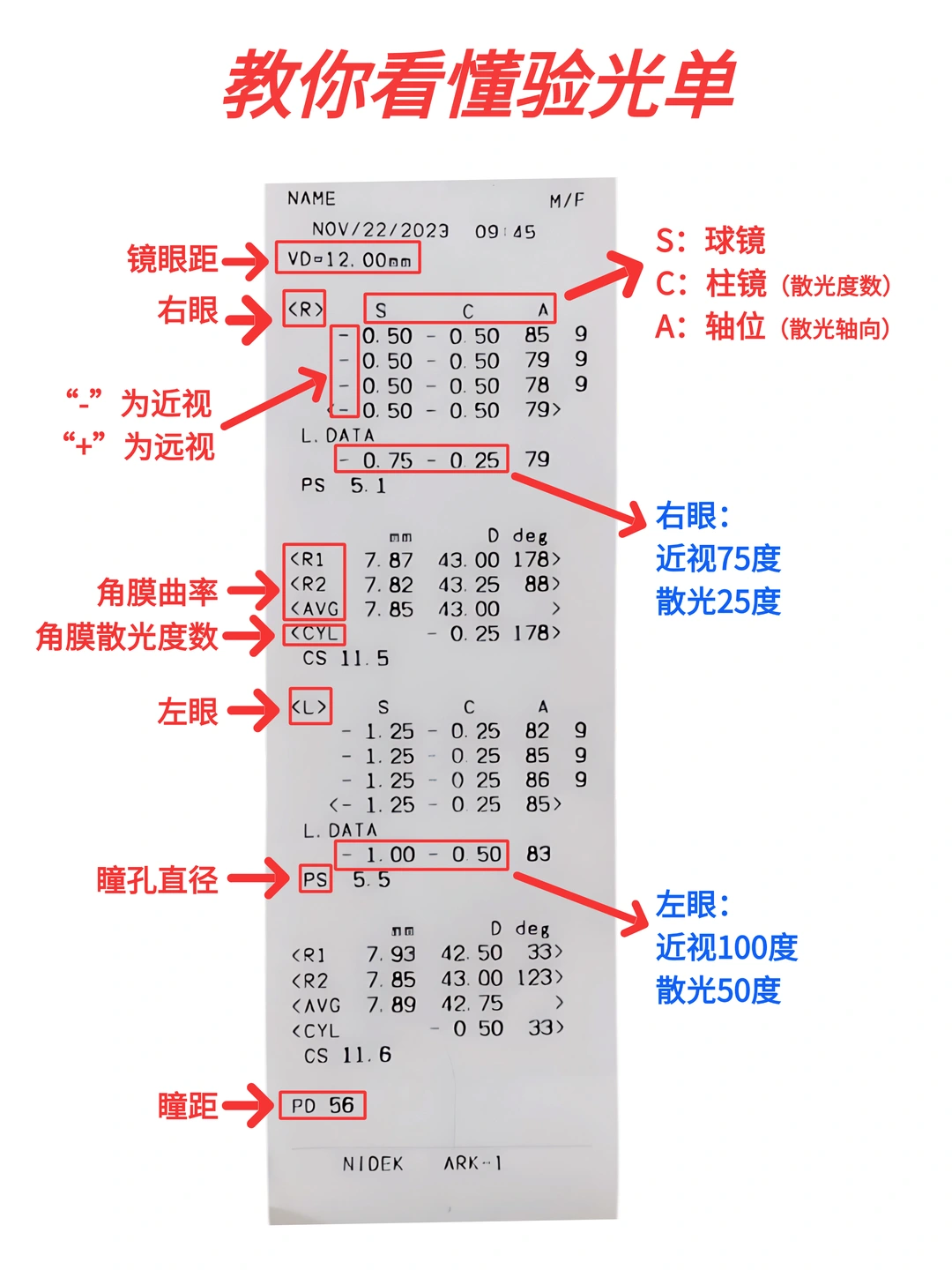 验光单看不懂❓这张图教你搞清楚……