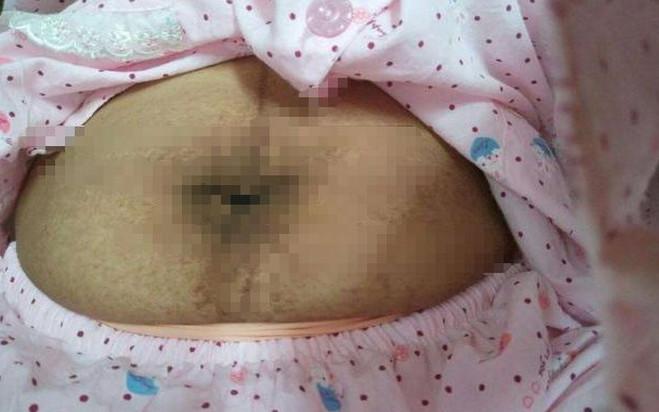 高龄产妇生为了生男孩再次怀孕, 不料医生看到产妇肚子后, 马上要求安排手术
