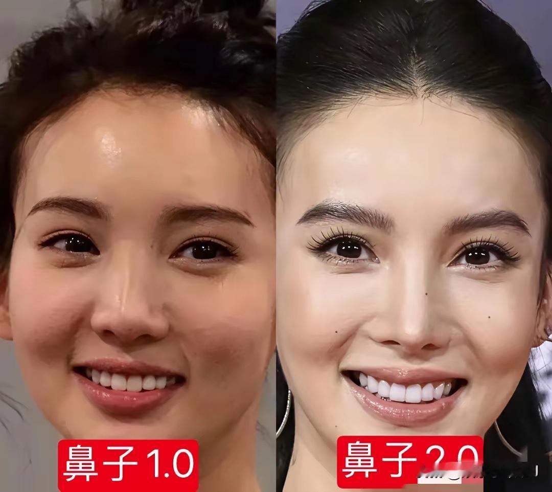 金晨以前不长这样！不要过度医美啊？哎！这已经不是医美了，整容加上太瘦就变样了，