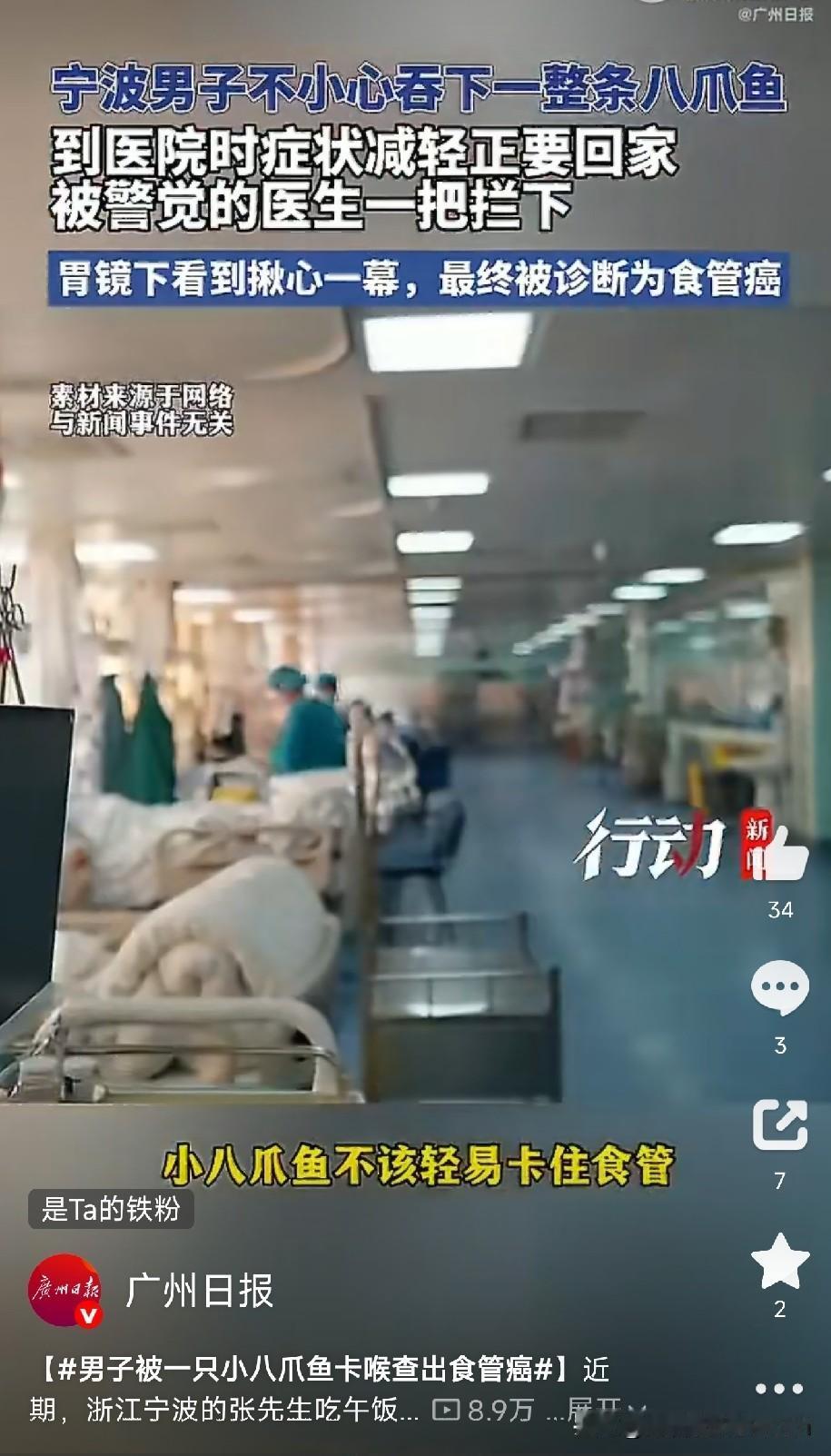 一只小八爪鱼卡喉，竟查出食管癌，这顿饭他吃得值浙江宁波的张先生，吃午饭时不
