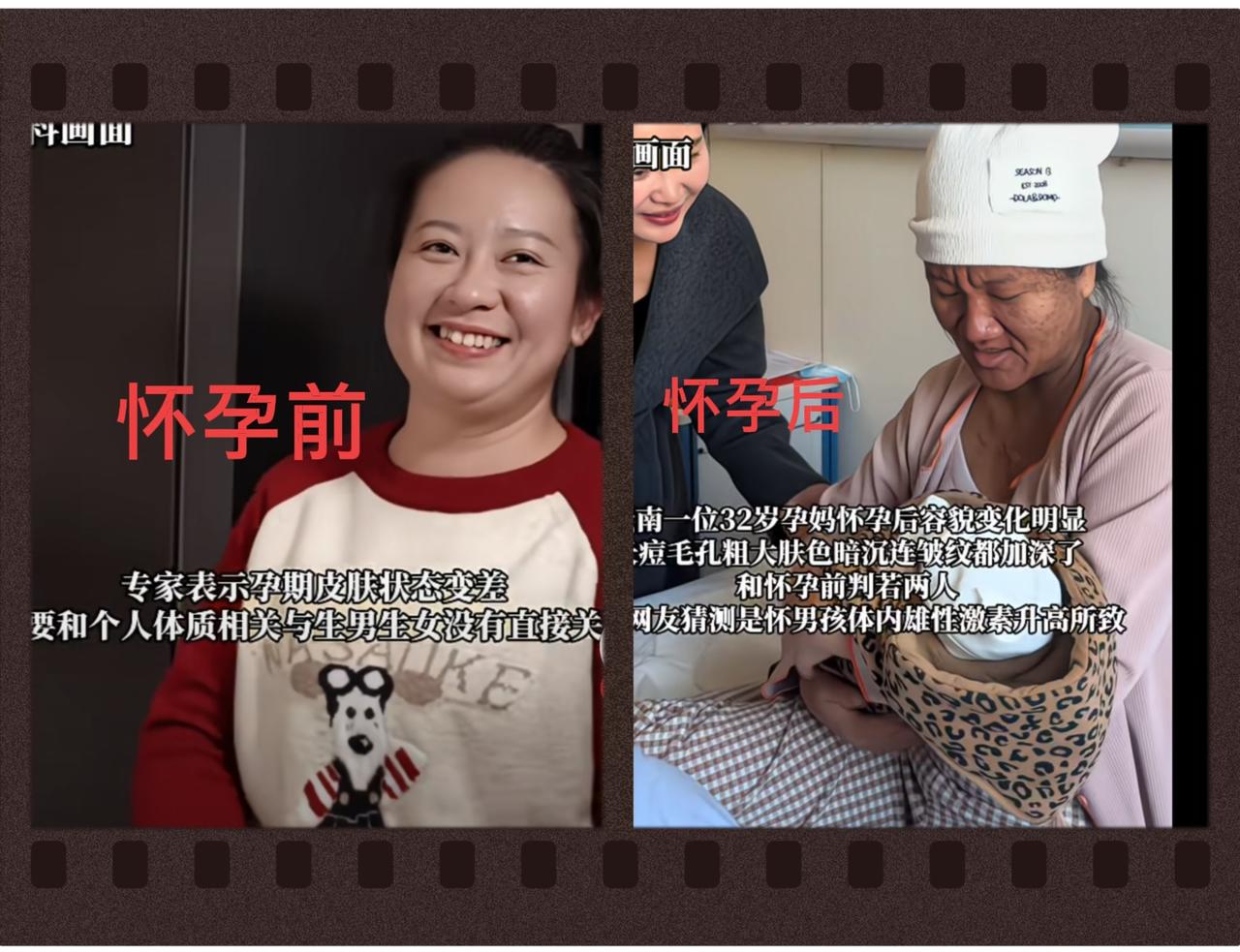 真头皮发麻，云南32岁宝妈怀孕前后相貌大变样，怀孕前皮肤白皙光滑，怀孕后皮肤黝黑