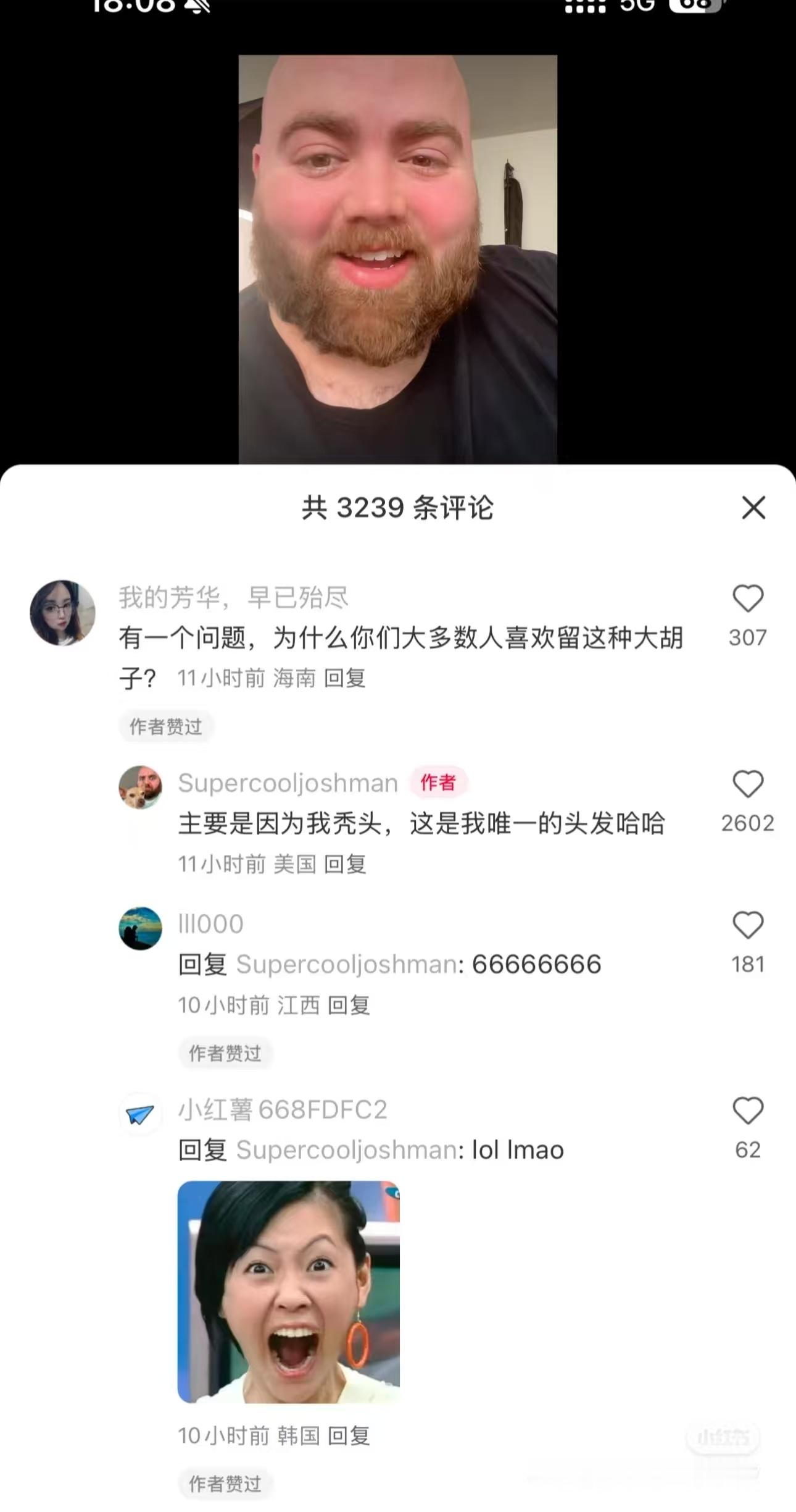 “为什么你们大多数人喜欢留这种大胡子?”