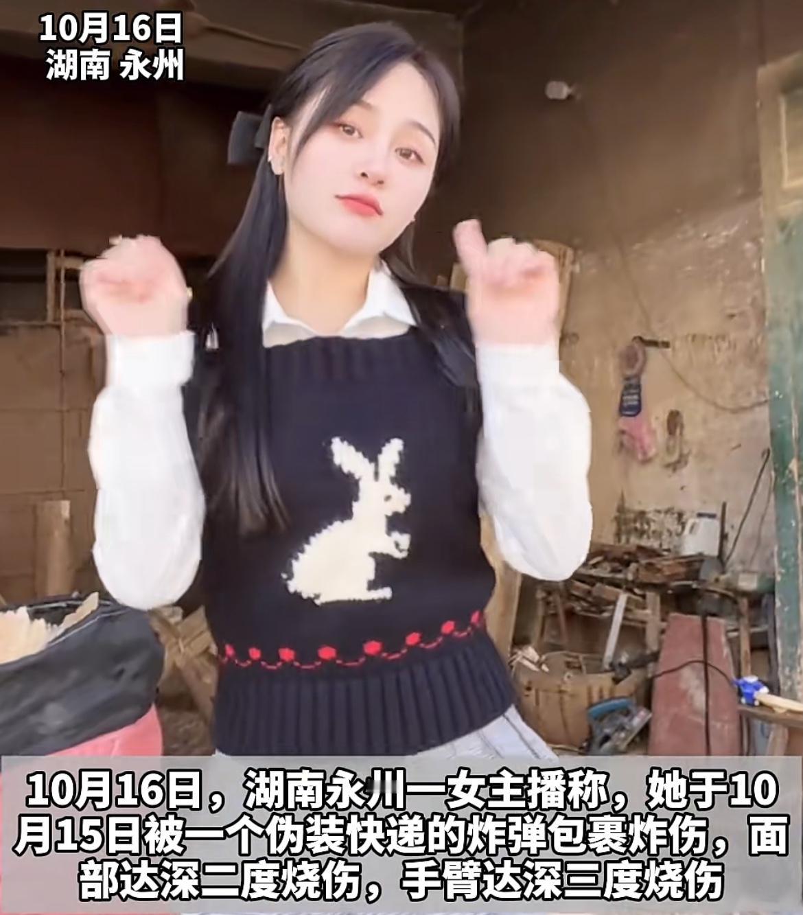 湖南永州一网络主播被伪装的快递炸弹毁容，身体多处深度烧伤，真相浮出水面。这名女孩