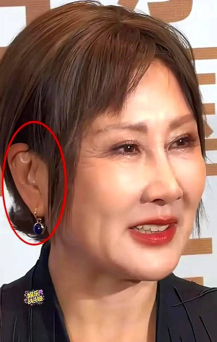 拿耳朵当整容证据，这届网友真有点东西。63岁的张凯丽走个红毯，网友拿着放大镜