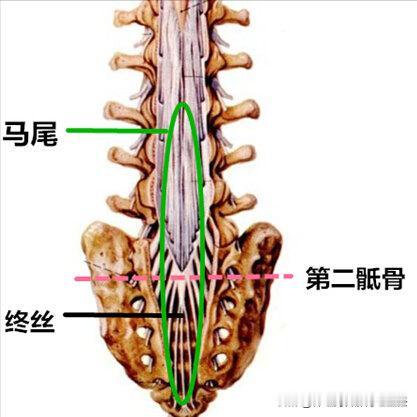 马尾神经受损之后，影响真的太大了 1.下肢无力或瘫痪马尾神经受损之后，患者