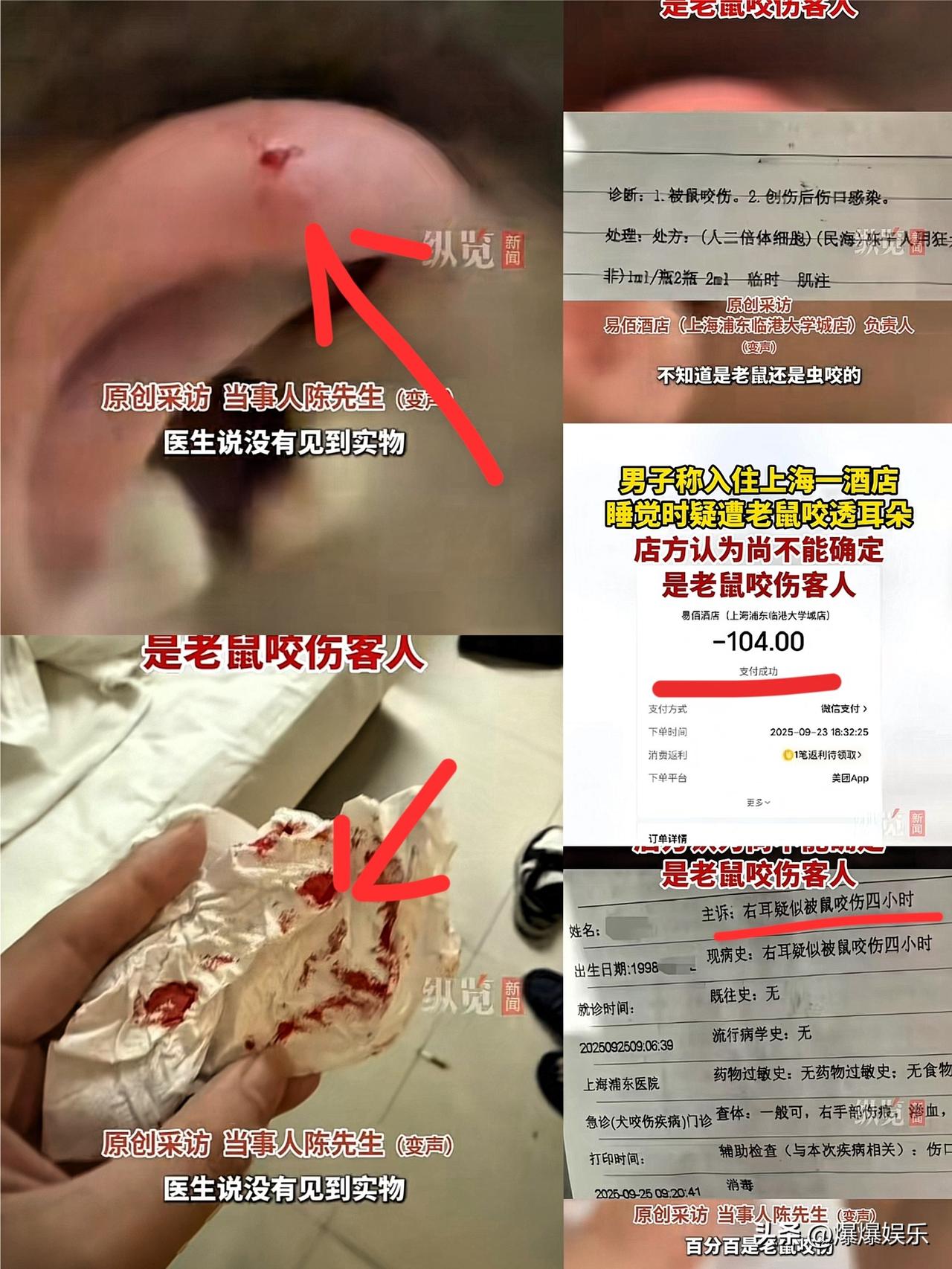 上海陈先生算是倒了大霉！住酒店时睡着觉，耳朵突然传来剧痛，开灯一看满手是血，耳