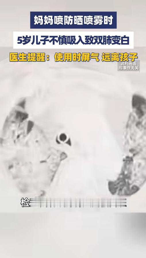 “千万不能吸进去！”6月5日报道，河南郑州，一位5岁的小男孩突然间咳嗽胸闷，到医
