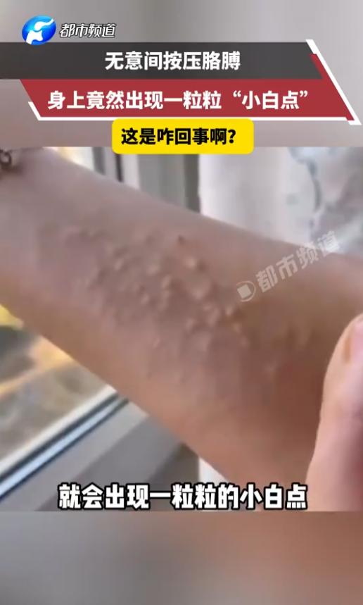 太吓人了！河南，一位网友洗完澡后只是无意间按了一下自己的胳膊，谁承想，皮肤底下竟