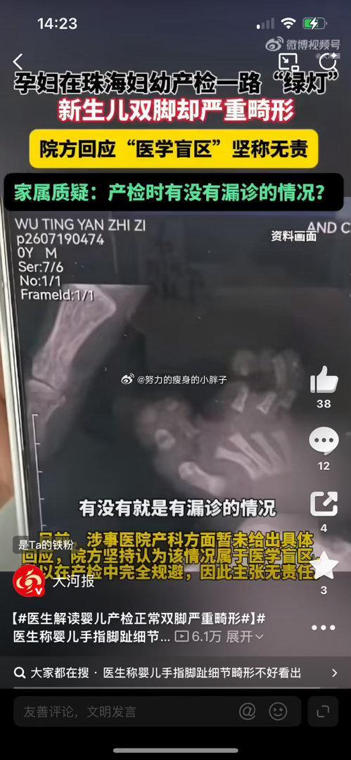 这类新闻已经看过好多次了，很多孕妈都有个误区，觉得产检次次正常，生出来的宝宝就肯
