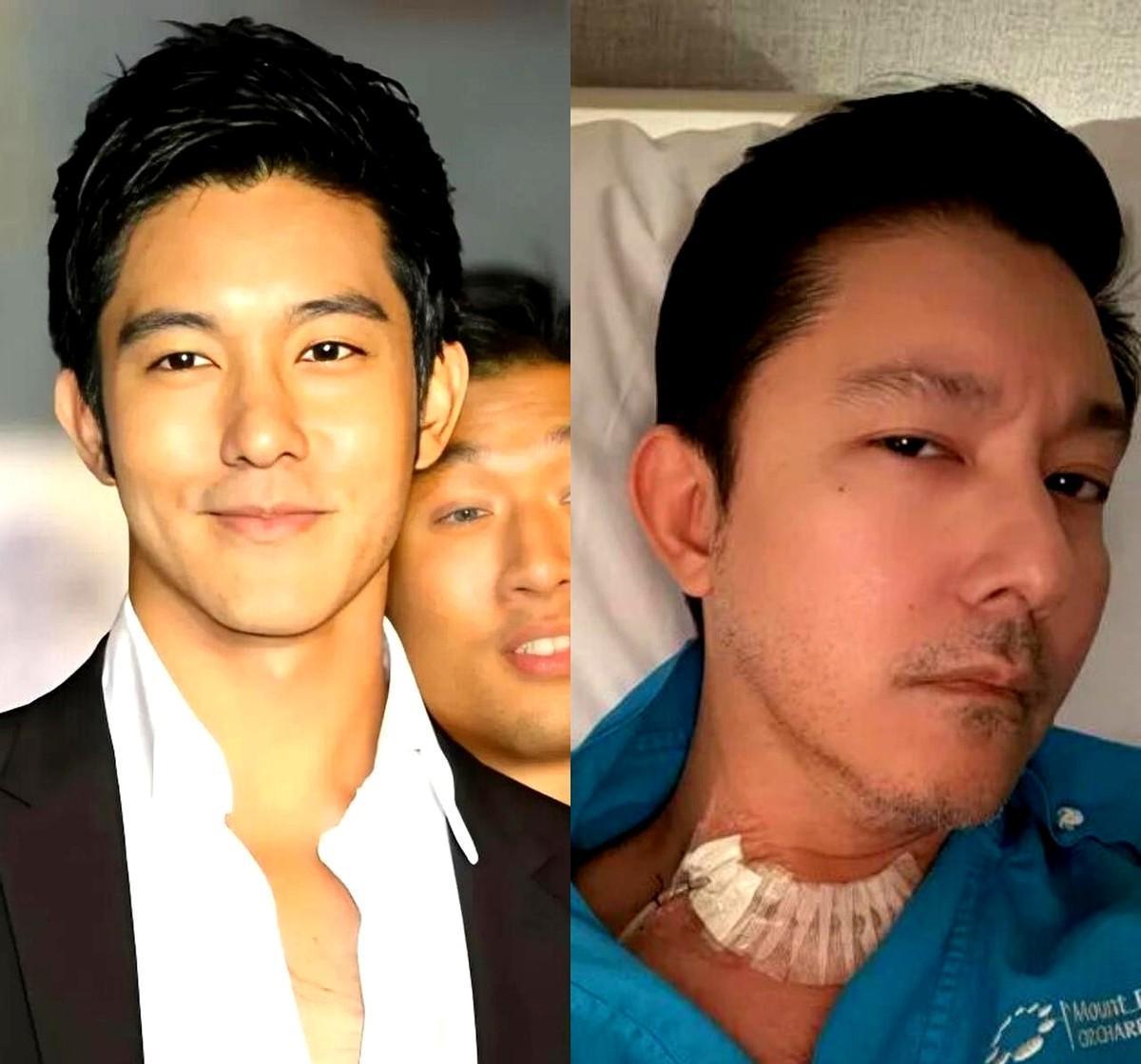 你说，什么手术能让一个男人拒绝千万片酬？答案是甲状腺切除。终身服药。201