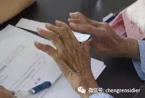 想要治疗斯蒂尔需要先知道这些