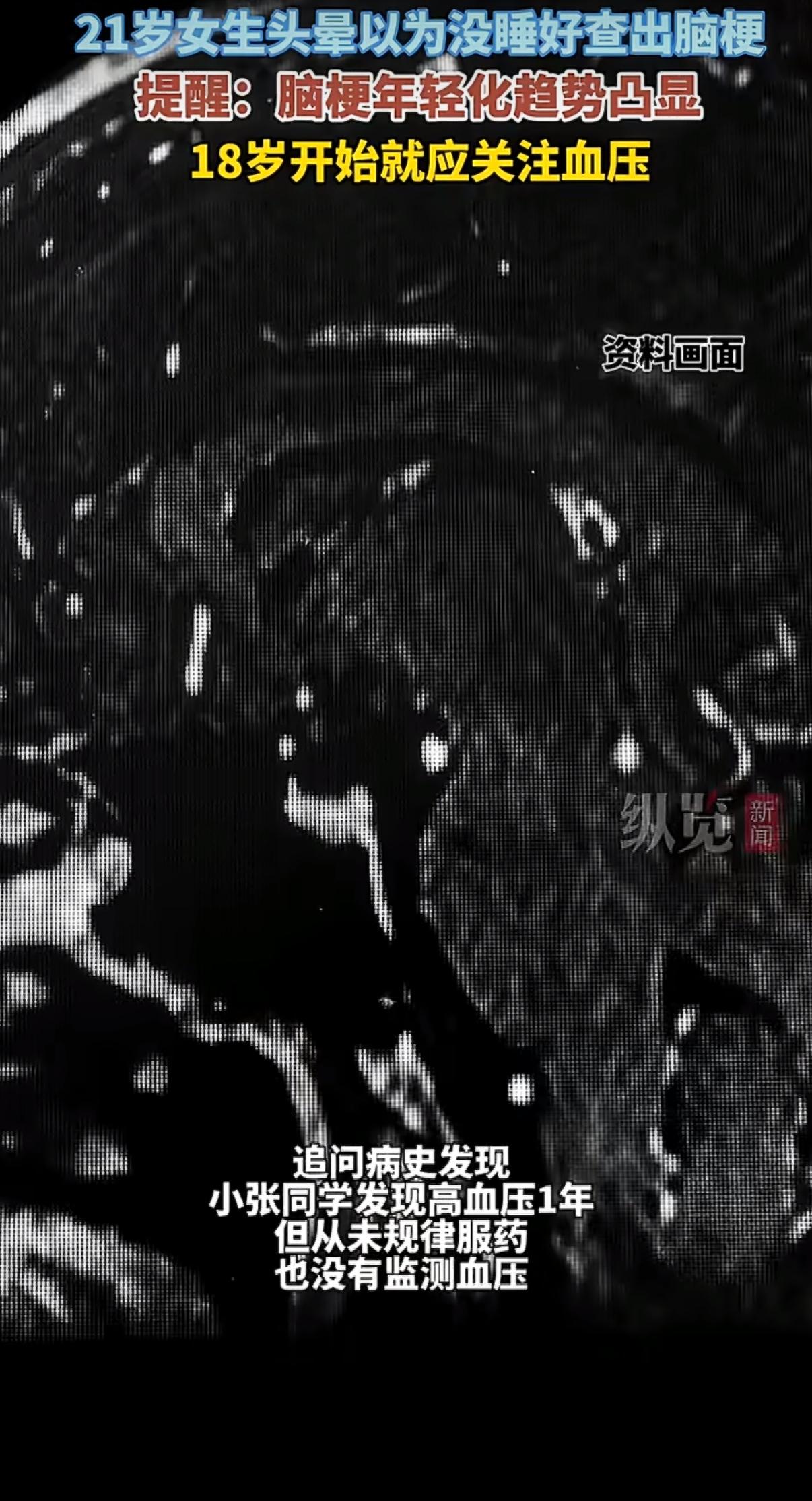 谁能想到，22岁的年纪，竟然会和脑梗、血管狭窄、动脉瘤这些听起来只属于中老年人的