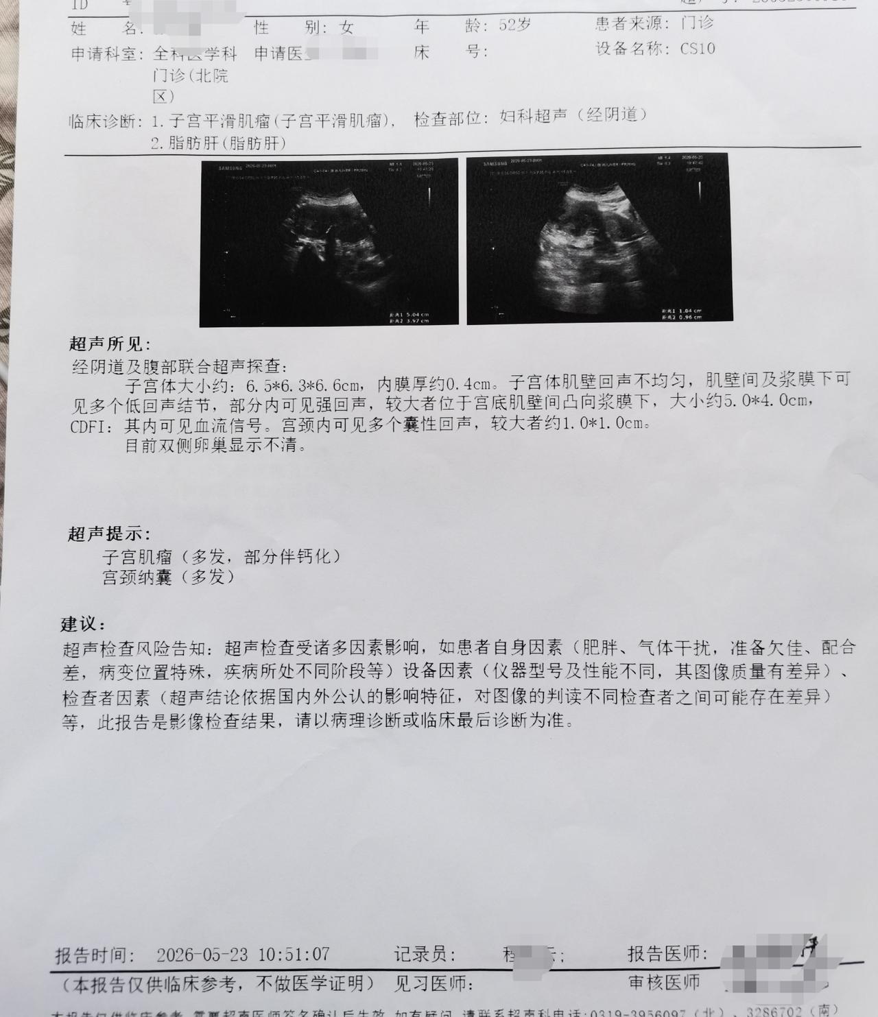 53岁，去年4月份最后一次月～经前几天，前几天我去医院做了阴～道B超（130元）