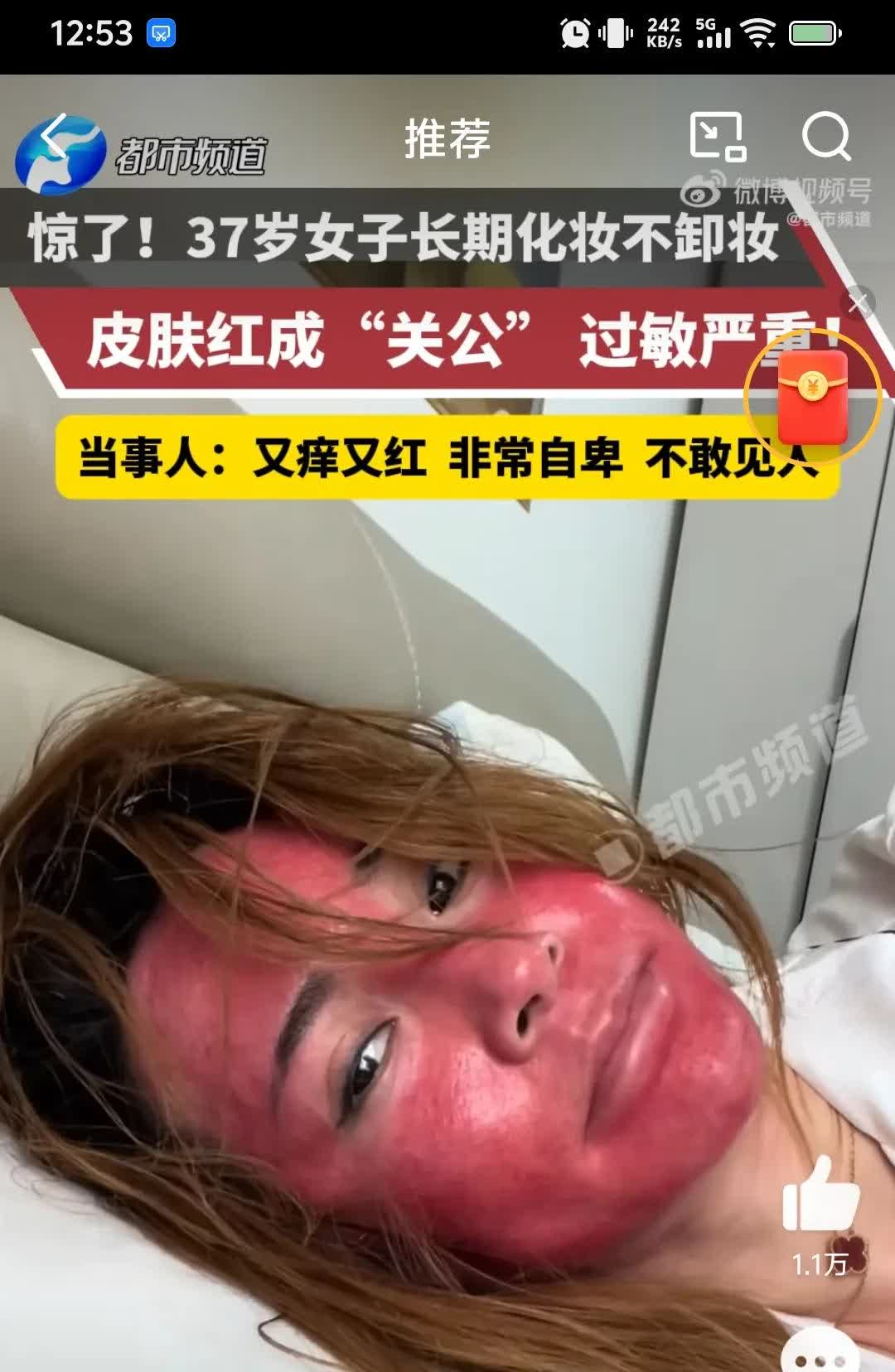 姐妹们，千万别偷懒！刚刷到的，37岁女子长期化妆不卸妆脸变成大红脸，严重过敏