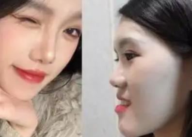 湖北武汉，一名24岁的女子去三甲口腔医院看牙，但在医生的建议下，花了8万元做了正