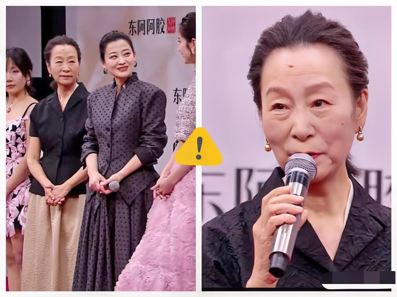 果然我不尴尬，尴尬的就是别人！奚美娟现身腾讯星光大赏的状态，直接把“人间清