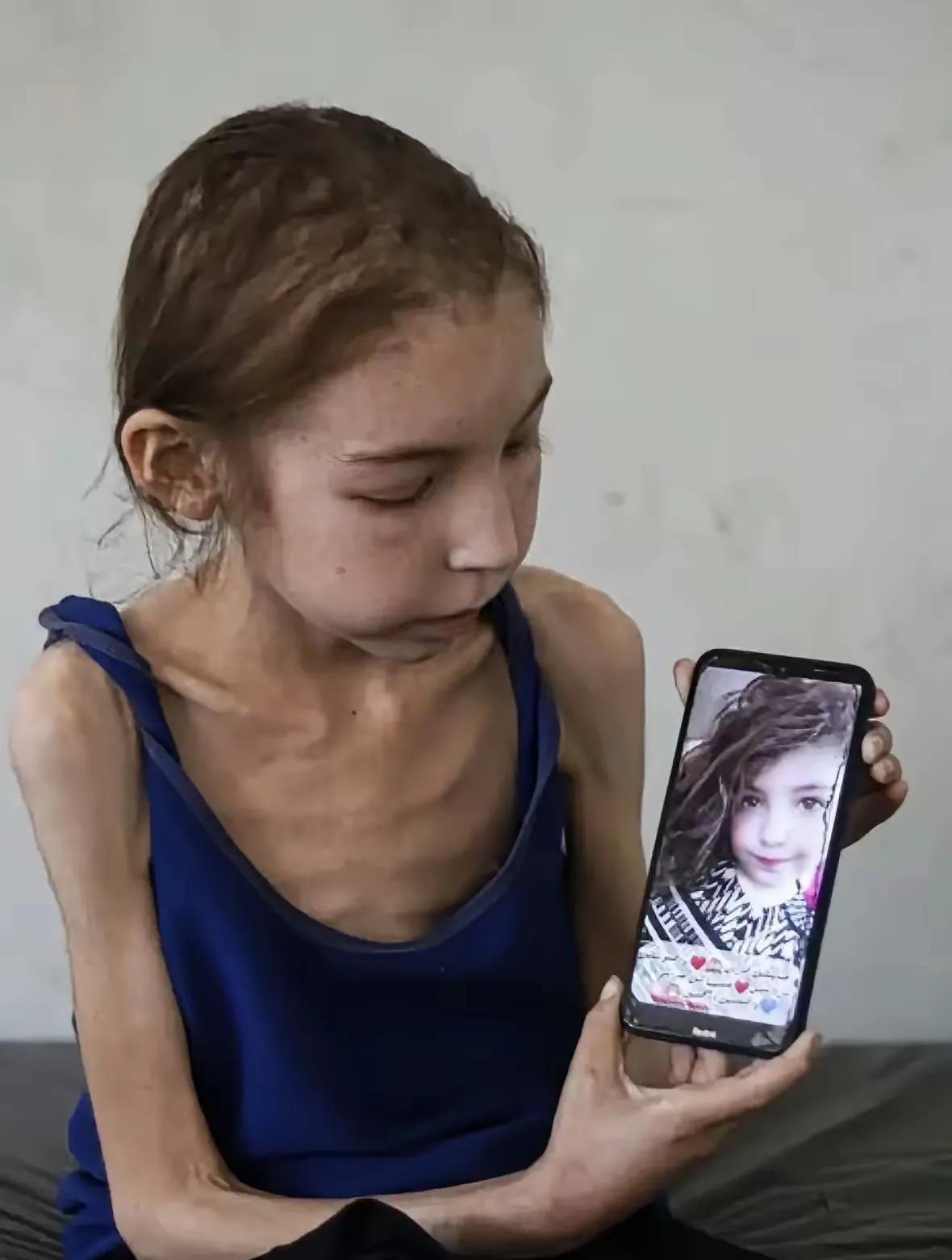这一位瘦骨如柴的姑娘是来自加沙地带。这时候怎么看到她身材非常地嶙峋瘦骨，非常让人