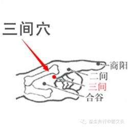 牙痛、手背肿？“三间穴”在指根后大家好，我是陈大夫！牙痛、手背发胀肿痛，很