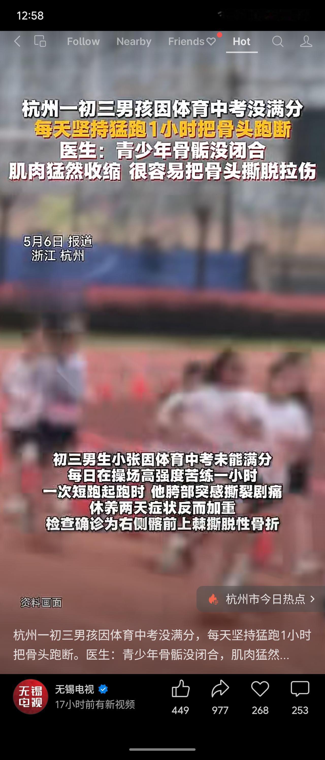 杭州一初三男生为体育中考满分，每日猛跑1小时，导致右侧髂前上棘撕脱性骨折。医生提