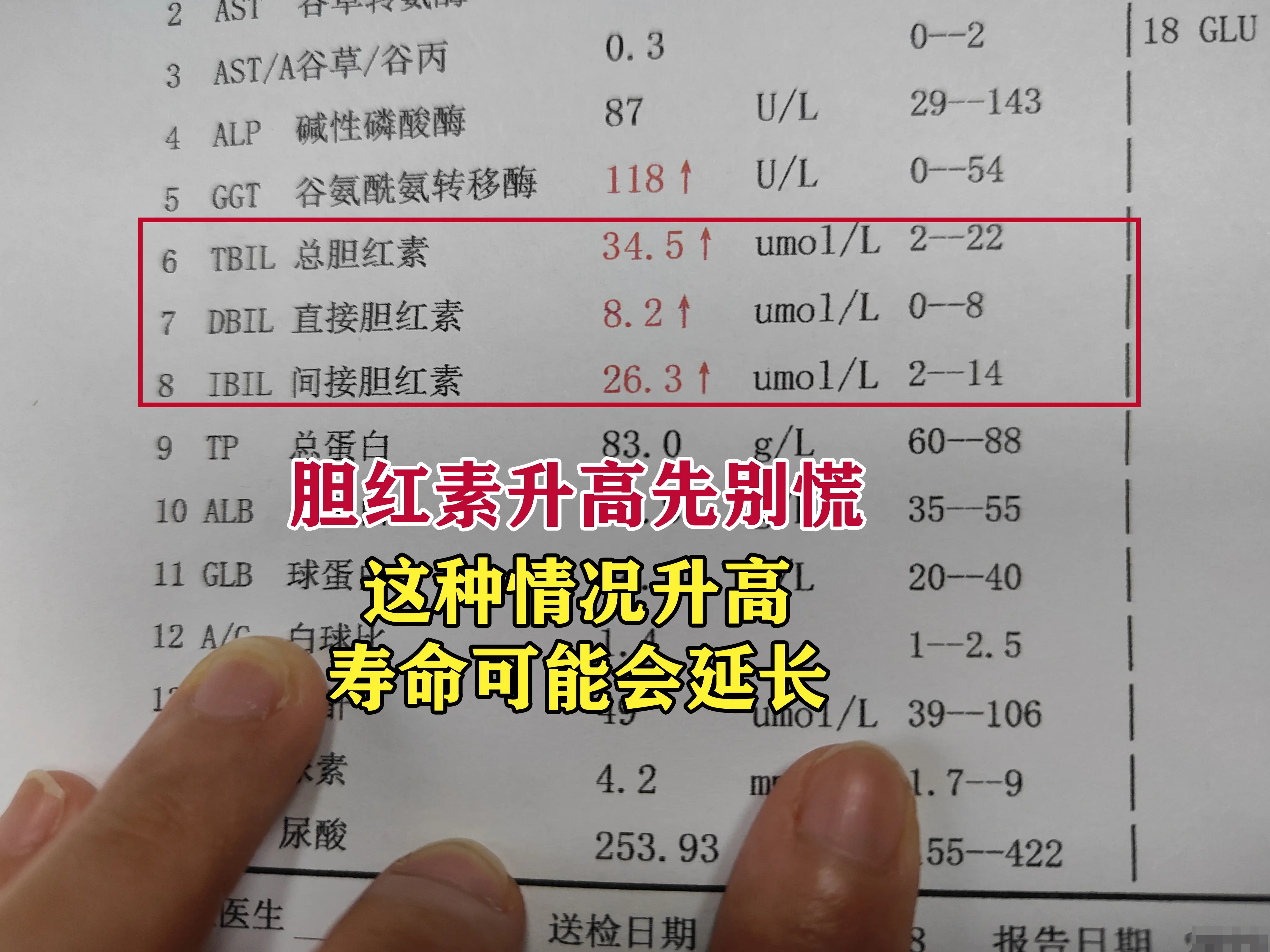 前段时间门诊来了个年轻小伙，体检查出胆红素40多，害怕往肝硬化发展。完...