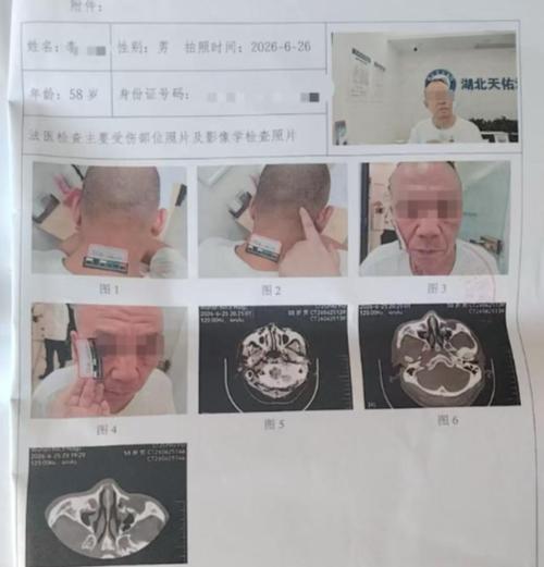 太冤了！湖北武汉，58岁男子在餐厅吃饭，邻桌几人一直大声吵闹拍桌子，男子就礼貌