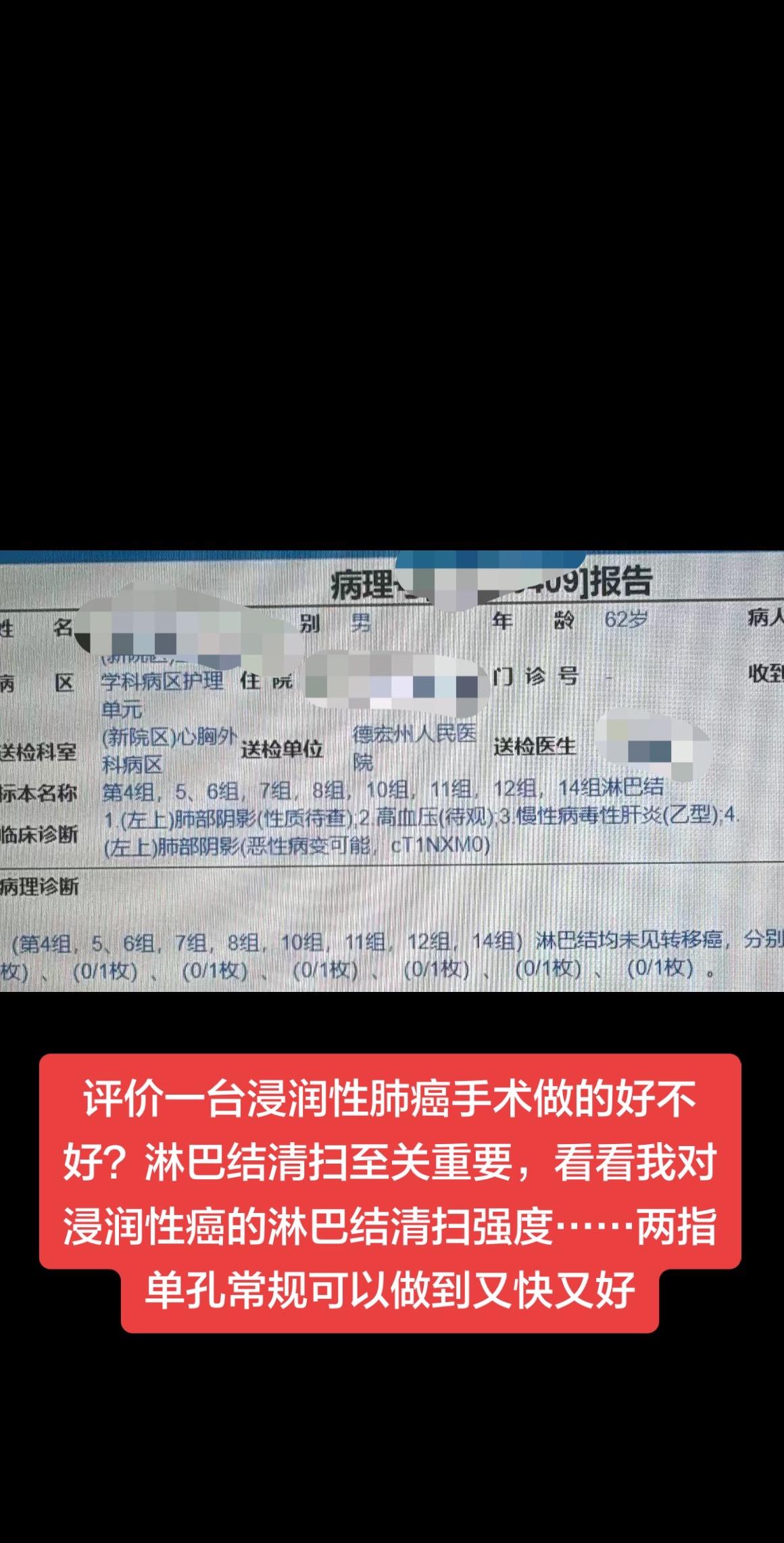 如何评价一台浸润性肺癌手术做的好不好？淋巴结清扫是关键……