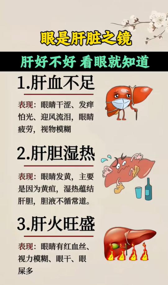 中医理论认为肝开窍于目，目为肝之外候，眼睛就像反映肝脏状态的一面镜子。肝血、肝气