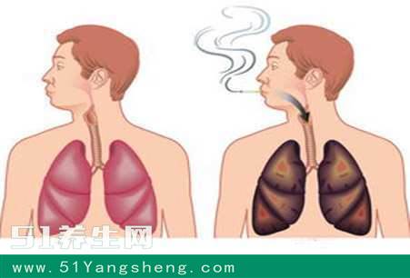 致烟民: 肺部健康小测试, 快来看看你的肺是否有得救