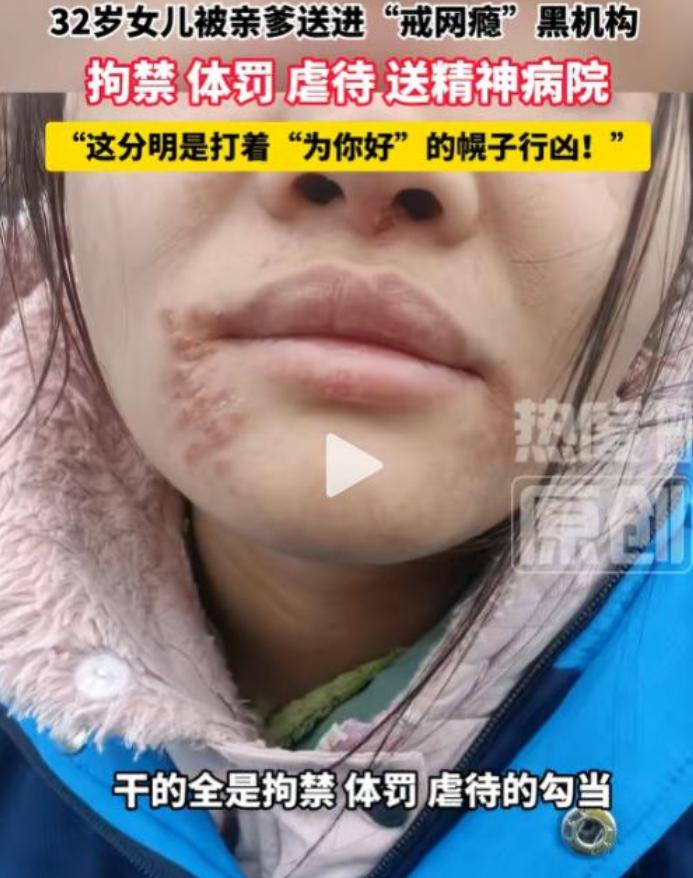 "都是为了你好"。湖北一位父亲竟强行把32岁的成年女儿送进一家教育机构进行封