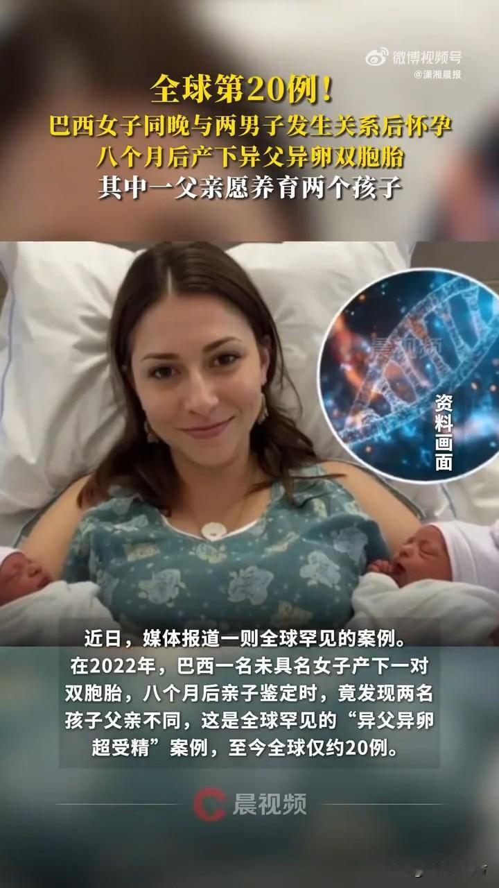 双胞胎有两个不同的父亲，异父异卵的现象也太抽象了吧！近日，媒体报道一则全球罕