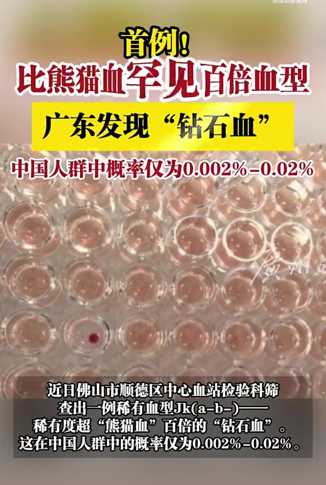 广东顺德发现“钻石血”！稀有度超熊猫血百倍，还是本地首例近日，广东顺德区中