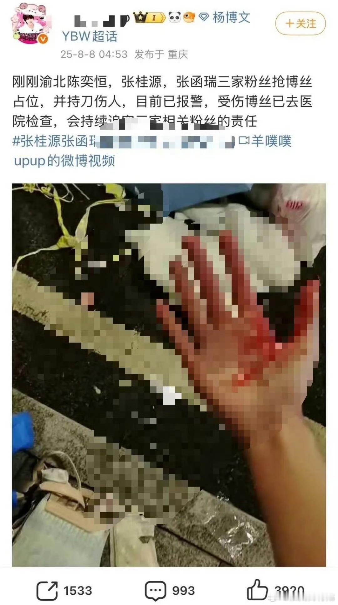 我去好可怕，追星还带着🔪啊​​​