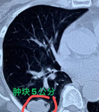 最近接诊的一个案例，让我心里特别不是滋味，想拿出来跟大家好好说说，希望能给更多人