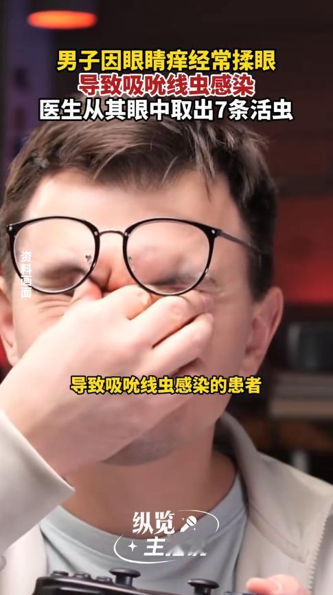 “悲剧还是发生了！”近日，重庆，一男子经常不洗手就揉眼，结果眼睛变得越来越痒，甚