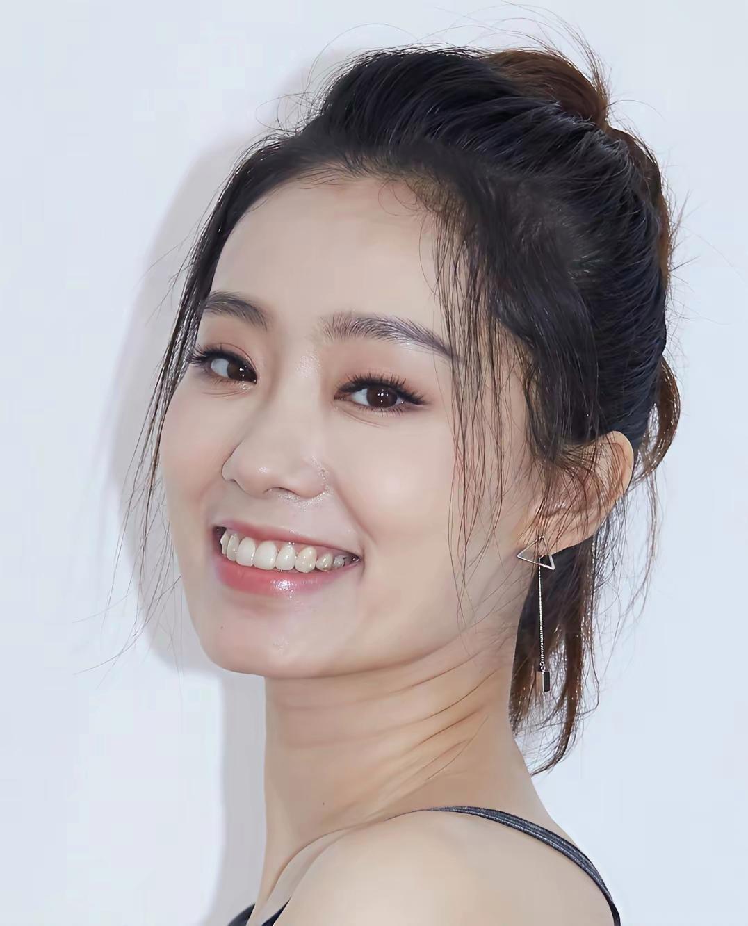 张小斐戴透明牙套了，还挺显眼