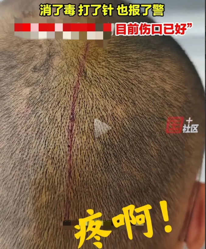 报警有用吗？报警抓谁？一光头男子正在大街上准备吸烟，突然感觉被谁拍了一下脑袋，