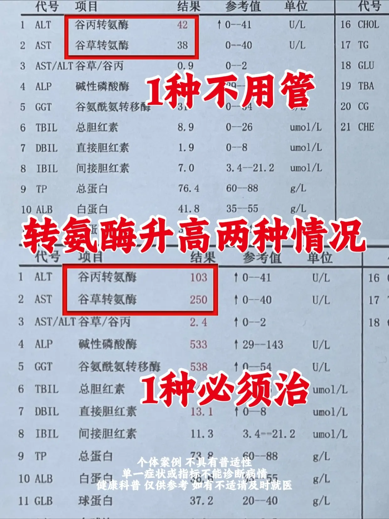转氨酶升高，一种不用管，一种必须治。很多人体检看到转氨酶升高，都会特别...
