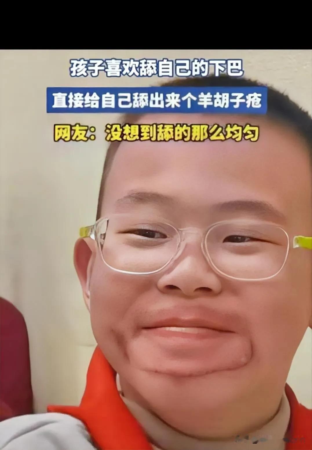 笑不活！浙江一男孩喜欢舔自己下巴，家长也没在意，觉得就是小孩闲得慌，结果，过一段