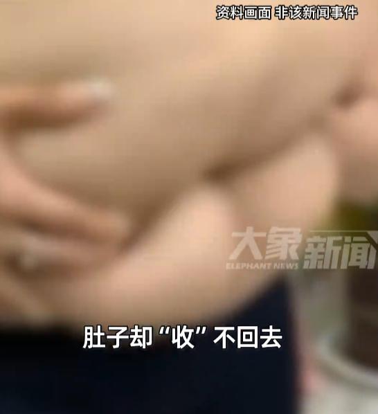 “天塌了！”7月26日报道，江苏，一女子体重高达300斤，为了摆脱肥胖带来的一系