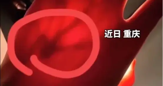 “网友留言救了我命…”女生拿手电筒照手,网友发现不对劲