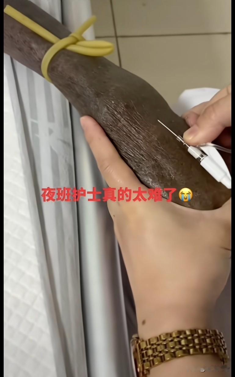 以为夜班护士比较闲，拿了一根淮山在练扎针呢，，哎，应该是尿毒症后期了还在想，为