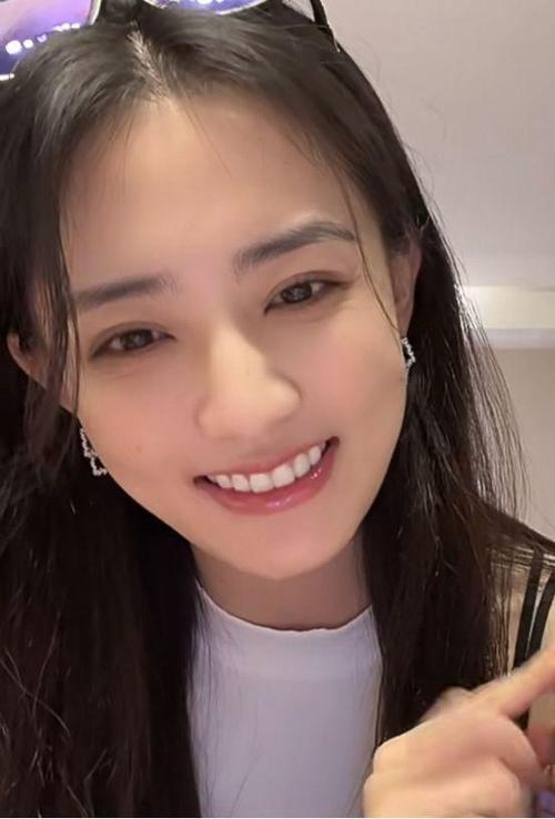演员徐璐在直播中大方自曝，为改善上镜效果做了上牙牙贴片。她坦言早期拍徐璐抹胸裙